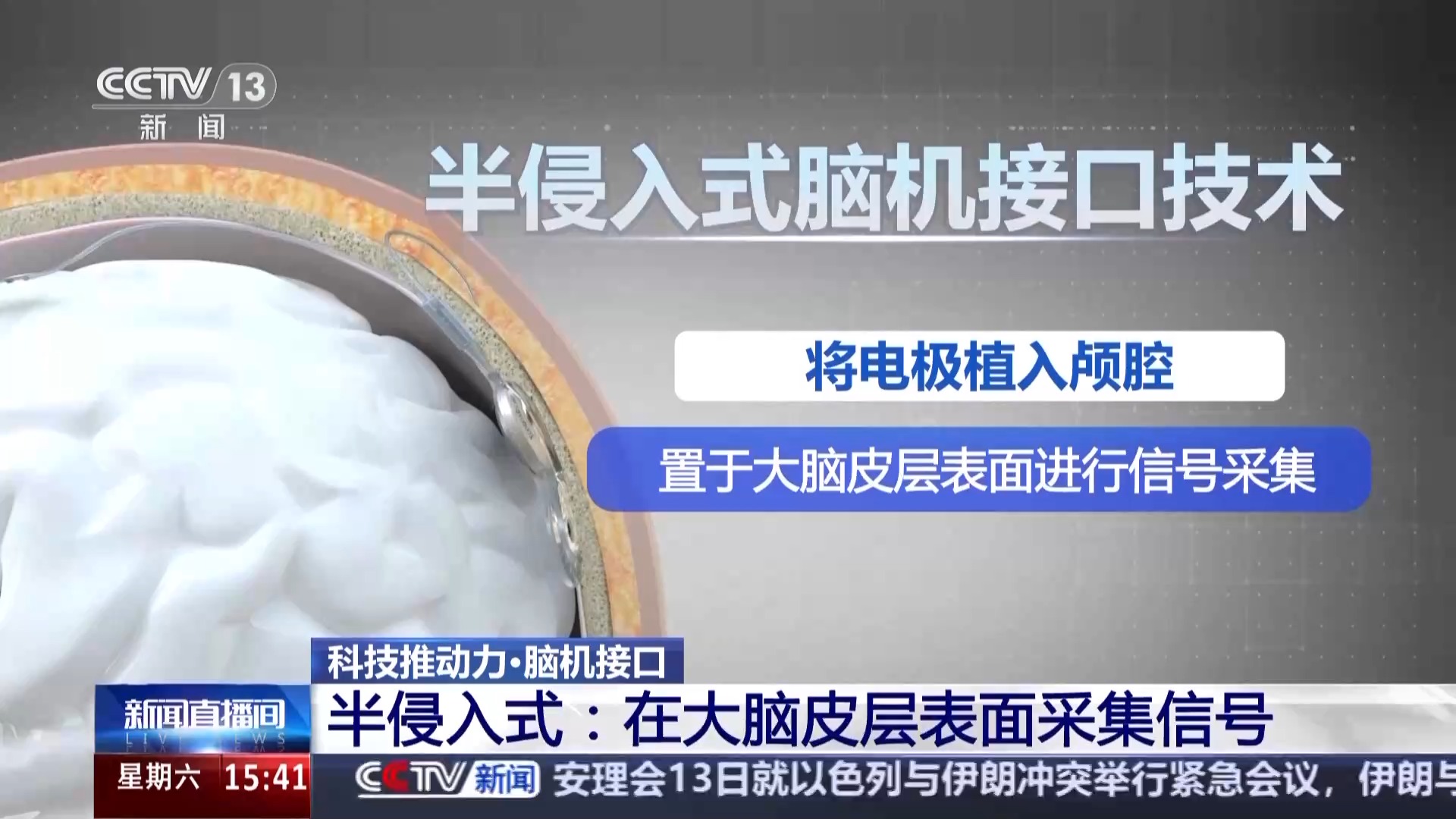 为意念装上现实“臂膀” 脑机接口助力“心想”到“事成”